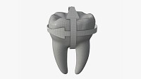 Tooth molars with arrow 01