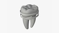 Tooth molars with arrow 02