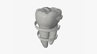 Tooth molars with arrow 03